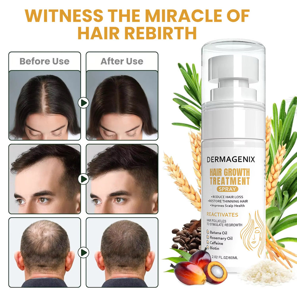 Dermagenix Hair Growth Treatment Spray - Batana + Rosemary + Biotin (20z) zieselo