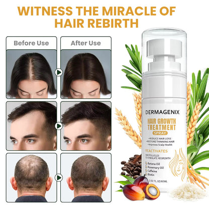 Dermagenix Hair Growth Treatment Spray - Batana + Rosemary + Biotin (20z) zieselo