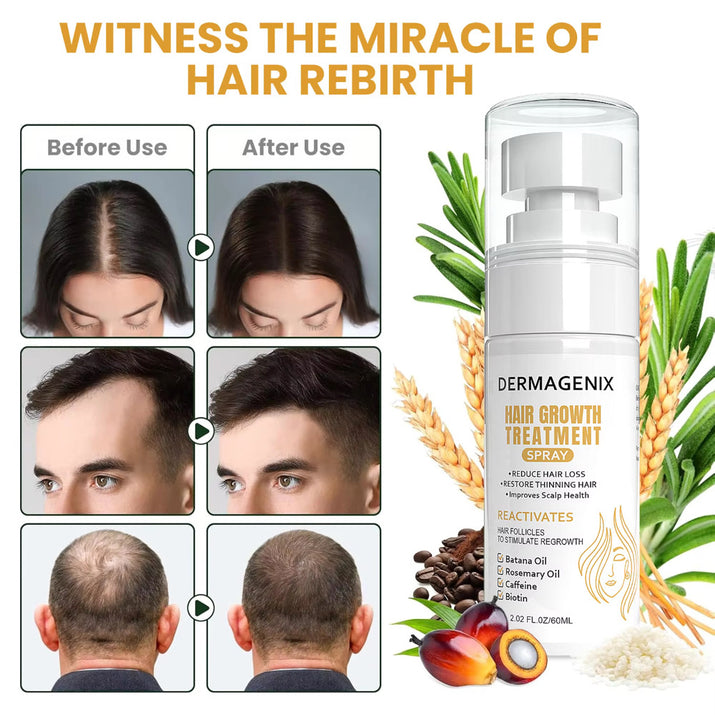 Dermagenix Hair Growth Treatment Spray - Batana + Rosemary + Biotin (20z) zieselo